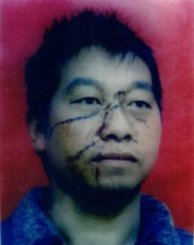 网传的胡秀祥2009年在北京上访被打伤的照片